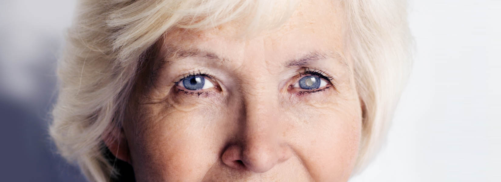 Cataract Surgery in Bainbridge Island